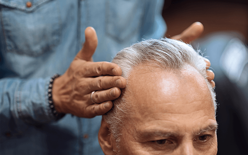 Man Having His Balding Hairline Examined