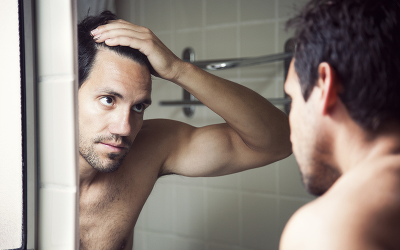 Man Looking In Mirror At Hairline